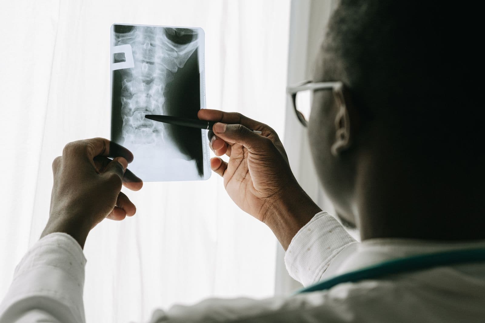 A clinician holding a spinal X-ray up to the light